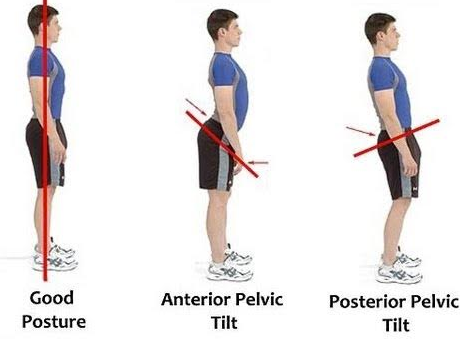 pelvic tilt